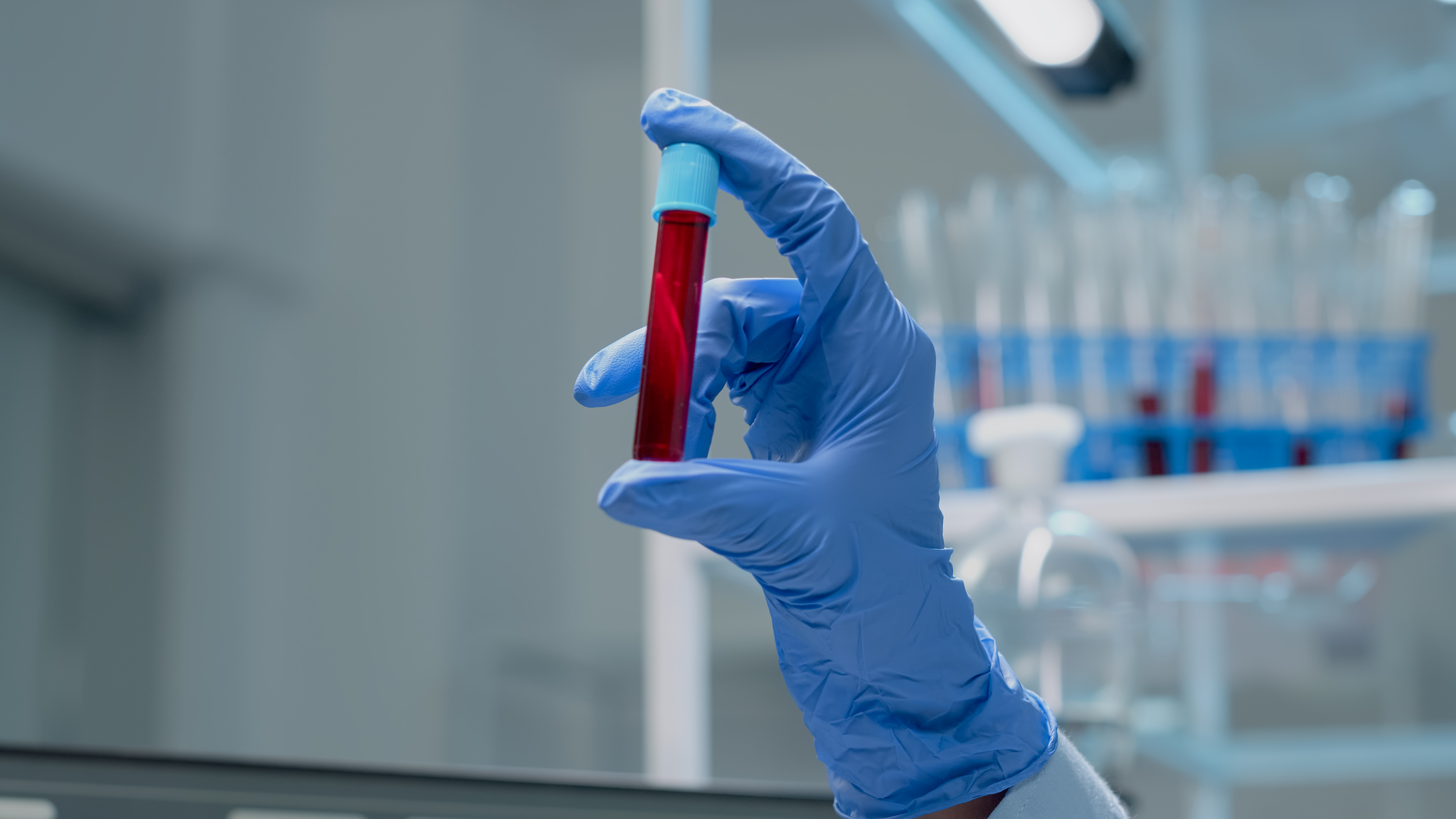 Comprehensive Blood Testing at SB Diagnostics